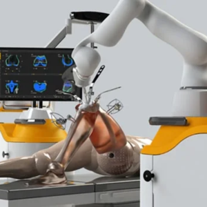 Robotic Joint Replacement Surgery