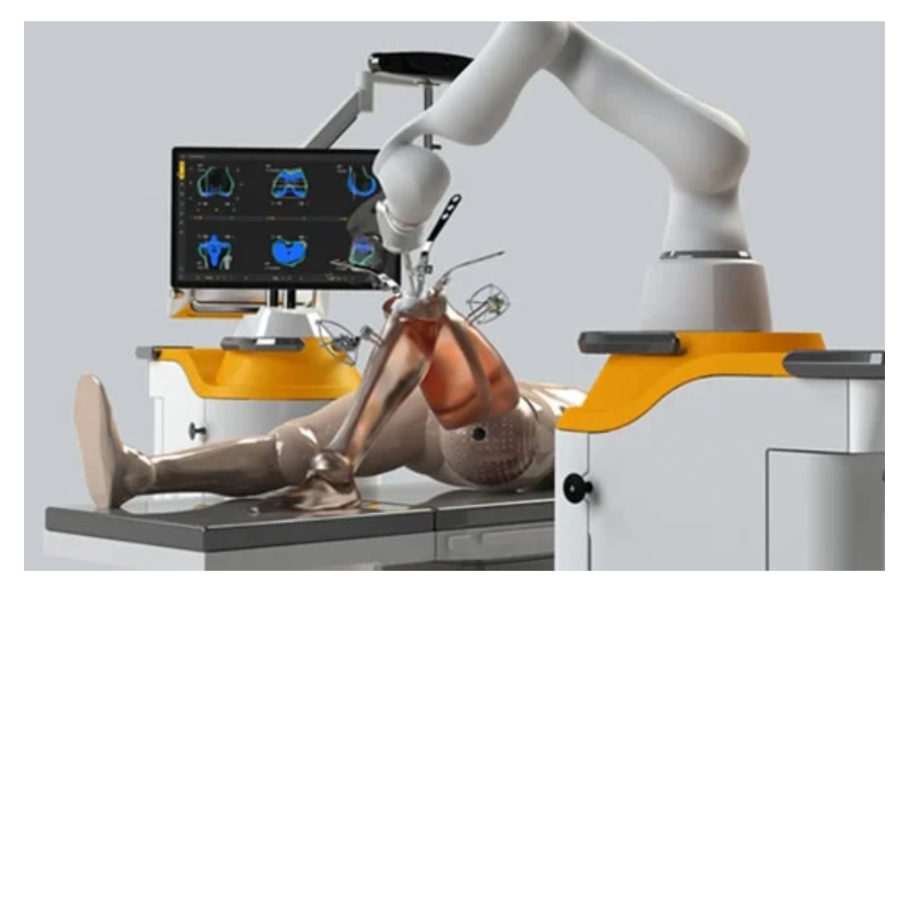 Robotic Knee Replacement Surgery in mumbai