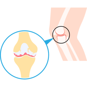 knee bone image