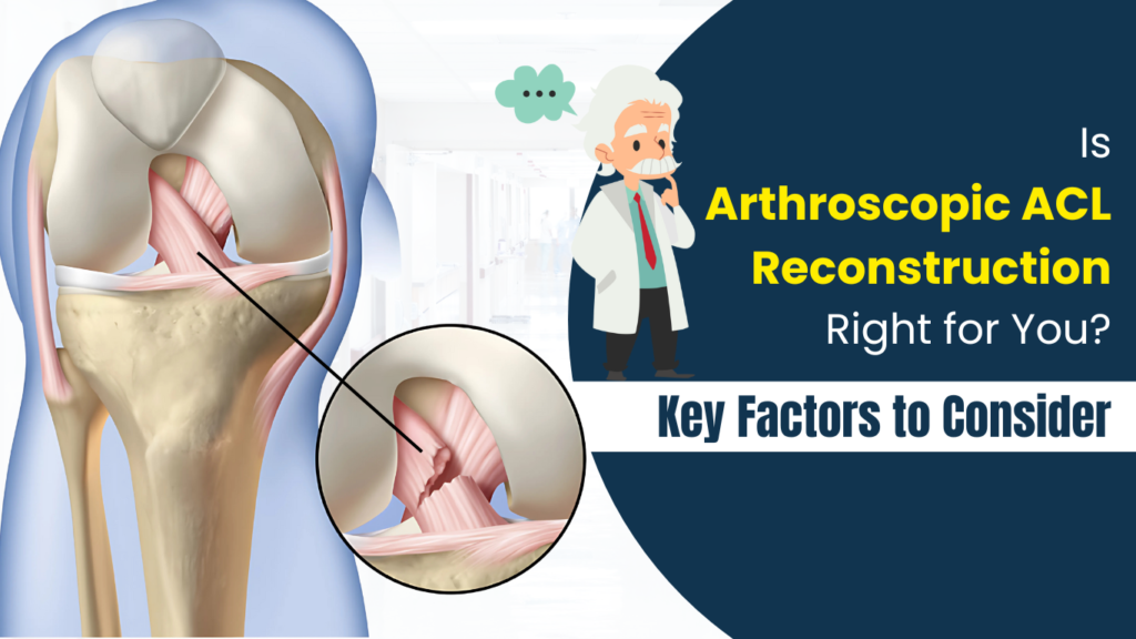 Arthroscopic ACL Reconstruction - Dr. Mohit Kukreja, Mumbai