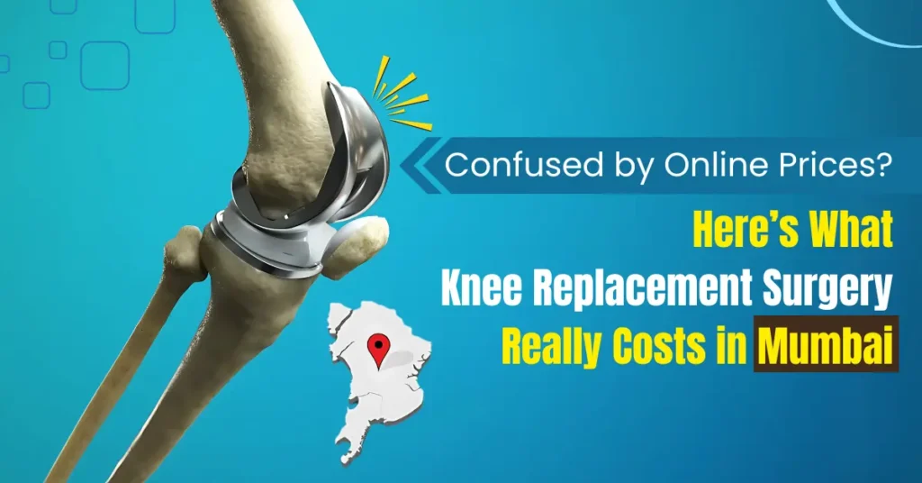 Cost of Knee replacement surgery in Mumbai