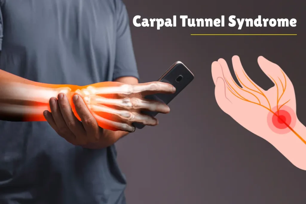 Carpal Tunnel Syndrome Treatment in Mumbai
